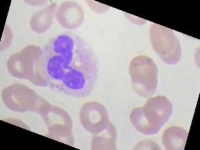 image of blood_cell