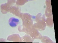 image of blood_cell