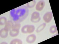 image of blood_cell