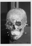image of skull