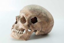 image of skull