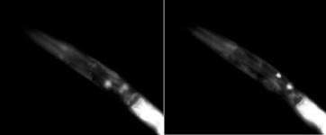image of nematode