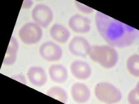 image of blood_cell
