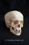 image of skull