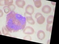 image of blood_cell