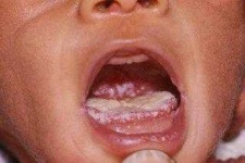 image of human_body_parts