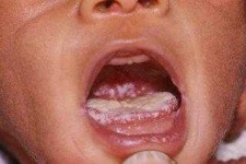 image of mouth #22