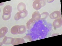 image of blood_cell