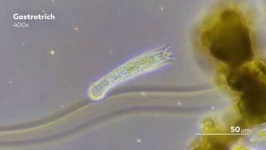 image of parasitic_flatworms