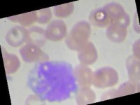 image of blood_cell