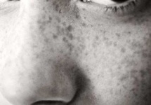 image of texture