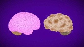 image of brain