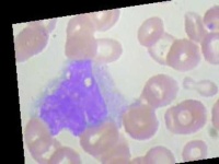 image of blood_cell