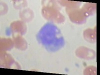 image of blood_cell