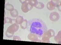 image of blood_cell