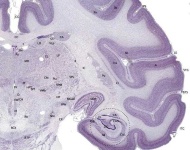 image of brain #3