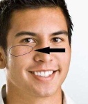 image of stitches