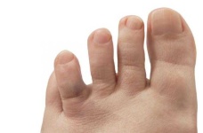 image of toe #25