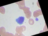 image of blood_cell