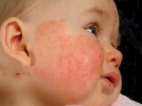image of infant