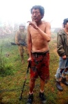image of crutch