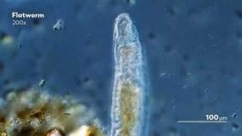 image of parasitic_flatworms