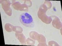 image of blood_cell