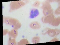 image of blood_cell