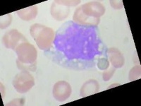 image of blood_cell