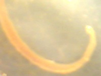 image of nematode