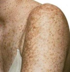 image of texture