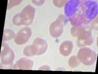 image of blood_cell