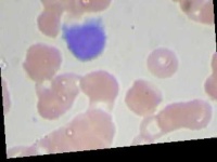 image of blood_cell
