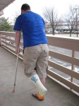 image of crutch