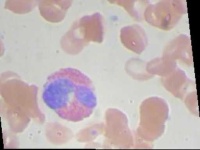 image of blood_cell
