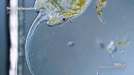 image of parasitic_flatworms