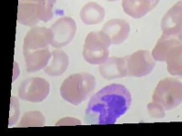 image of eosinophil