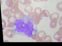 image of blood_cell