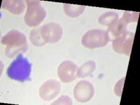image of blood_cell