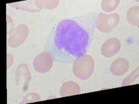 image of blood_cell