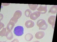 image of blood_cell