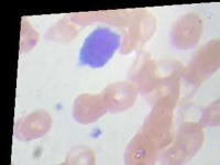 image of lymphocyte