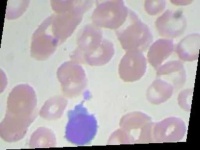 image of blood_cell