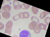 image of blood_cell