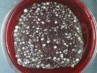 image of petri_dish