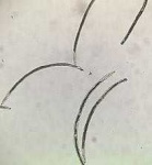 image of nematode