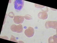 image of blood_cell