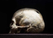 image of skull