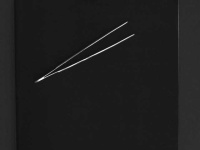 image of surgical