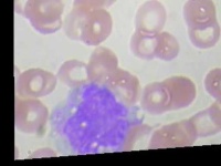 image of blood_cell